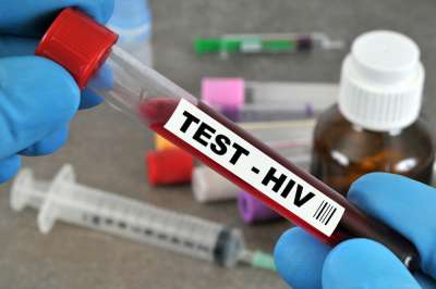 Подтвержден второй случай полного излечения от ВИЧ